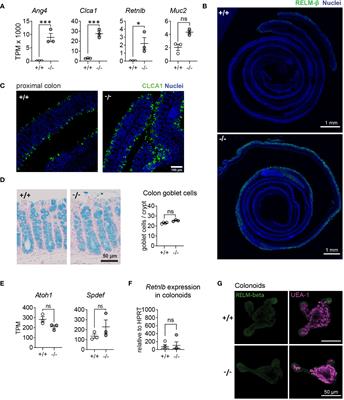 Mmp17-deficient mice exhibit heightened goblet cell effector expression in the colon and increased resistance to chronic Trichuris muris infection